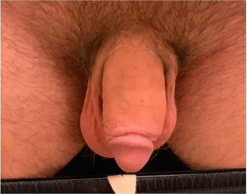 Enhancement_after_04
