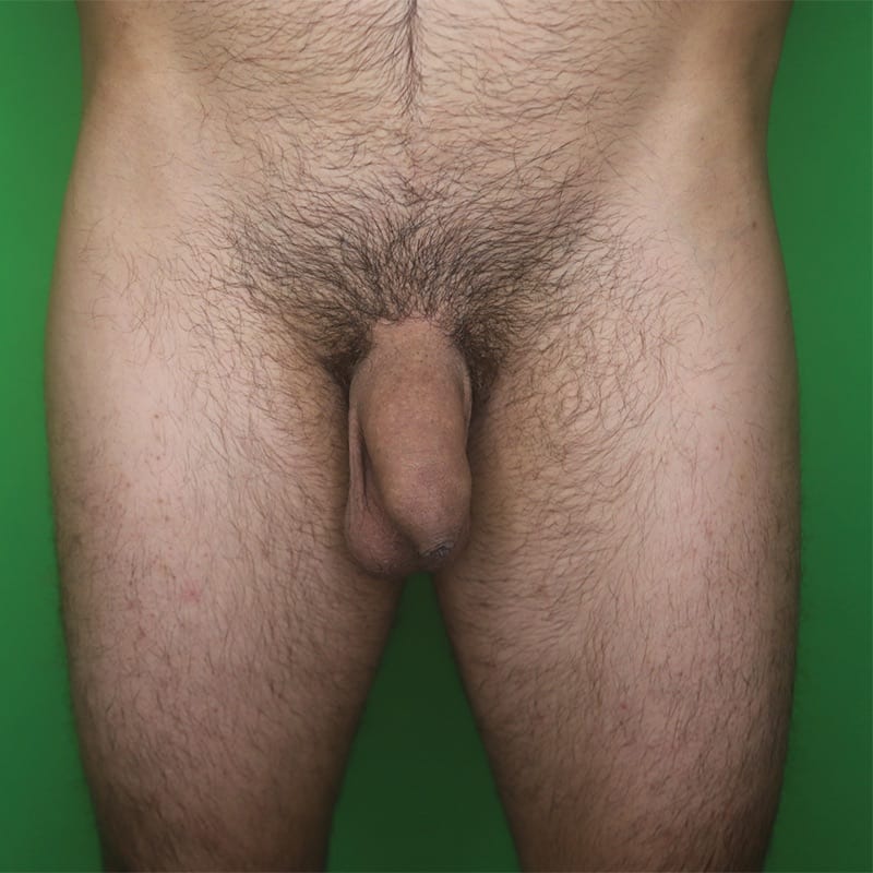 Enhancement_before_13